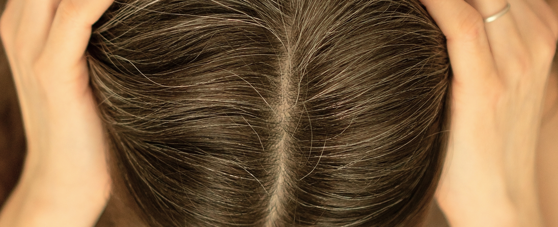 Mezoterapije kose i vlasišta