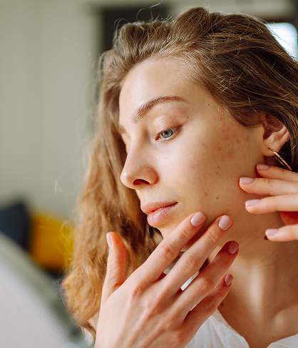 Nuspojave onkološkog liječenja na koži mogu se spriječiti, dr. Rosović objašnjava kako